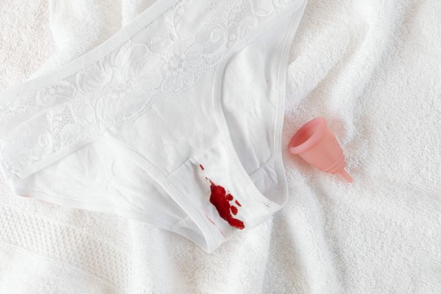 Pap smear Nigeria